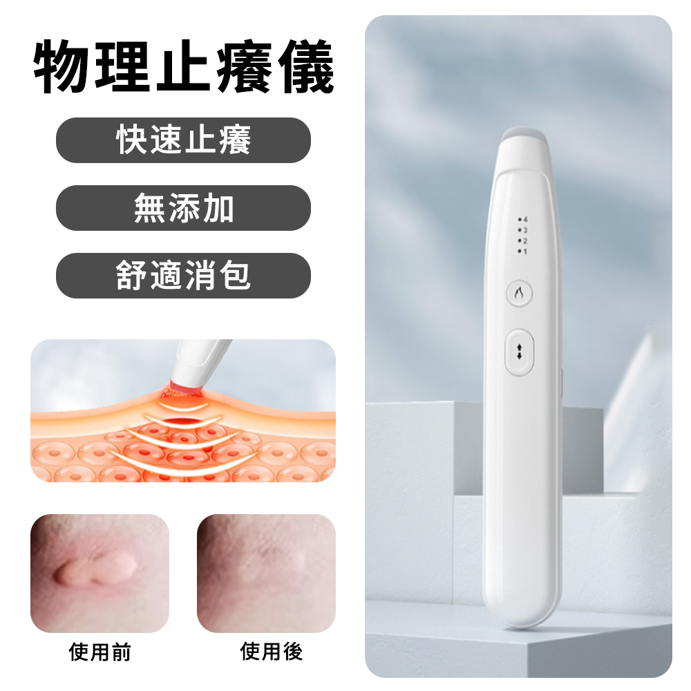 Lew 智能止癢儀 戶外蚊蟲叮咬止癢筆 露營蟲咬止癢器 加熱舒緩棒 物理快速止癢 無化學成分 可調溫