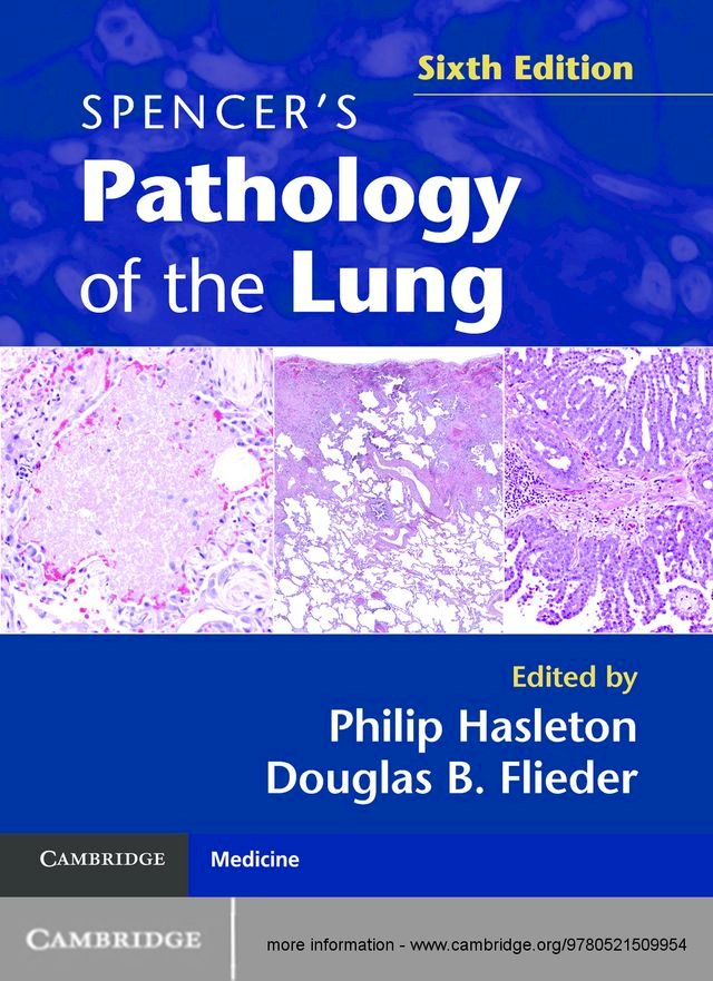 Kobo Spencer's Pathology of the Lung